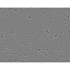 Rat Dorsal Root Ganglion Neurons (rDRGN)